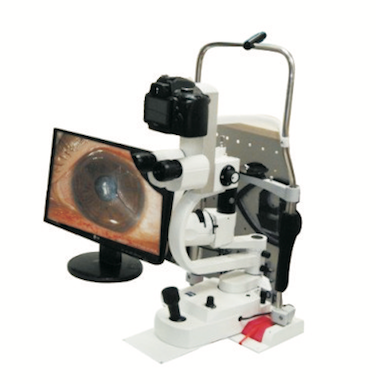 Digital Imaging Solution to Zeiss SL-115 Slit lamp