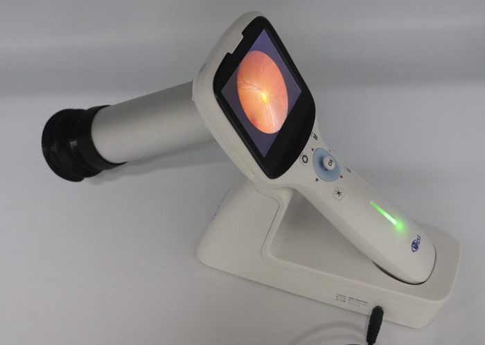 Portable  non-mydriatic Fundus Camera