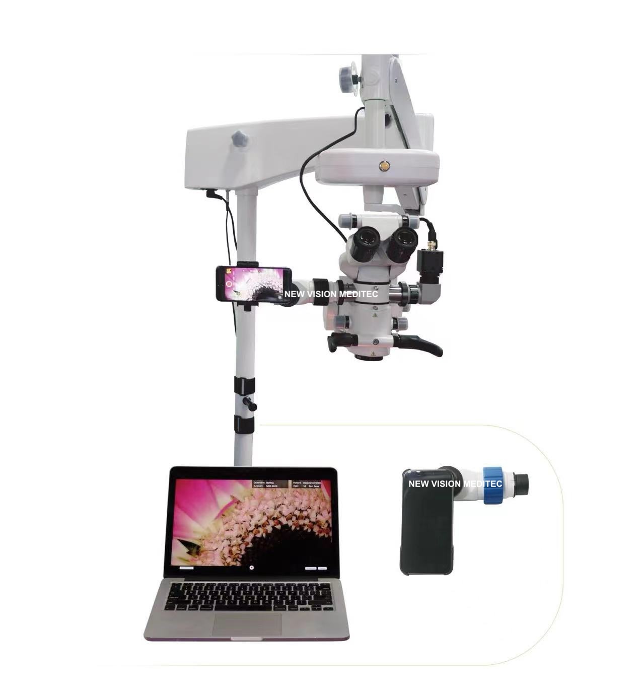 Smartphone Video Adapter (for surgery video recording)